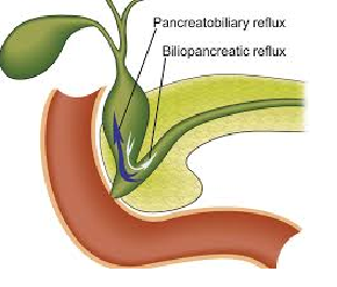 Pancreatectomy in Bangalore