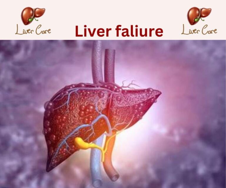 liver failure treatment in Bangalore