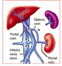 portal hypertension